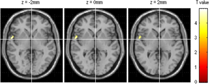 Fig. 3