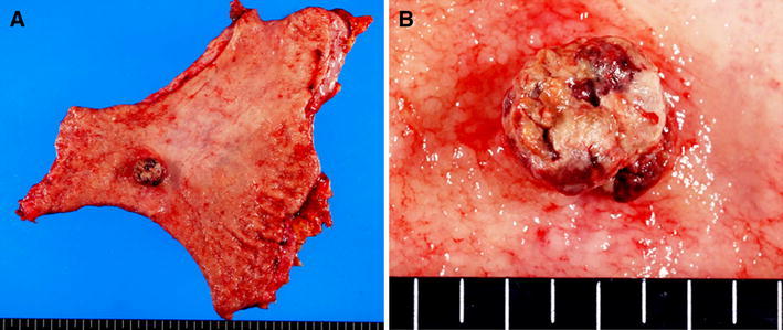 Fig. 4