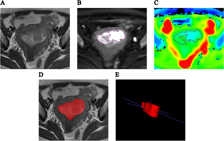 Fig. 1