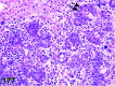 Figure 177