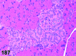 Figure 187