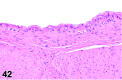 Figure 42