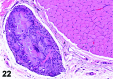 Figure 22