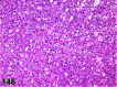 Figure 146