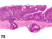 Figure 75