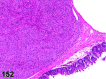 Figure 152