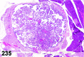 Figure 235