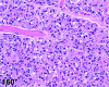 Figure 160
