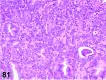 Figure 81