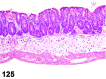 Figure 125