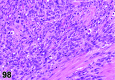 Figure 98