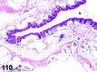 Figure 110