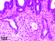 Figure 122