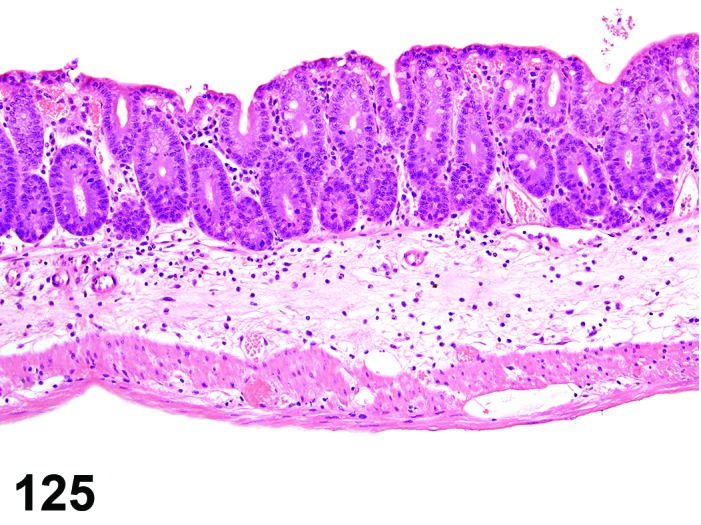 Figure 125