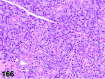 Figure 166