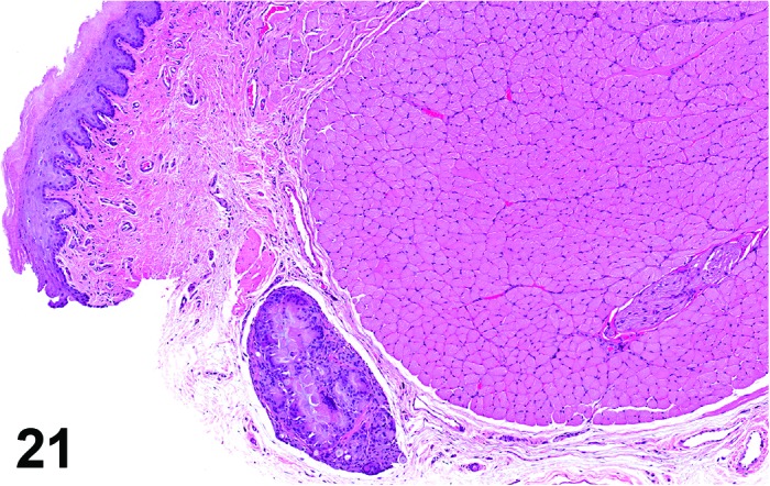 Figure 21