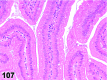 Figure 107
