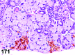 Figure 171