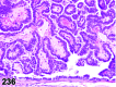 Figure 236