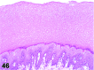 Figure 46