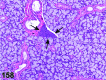 Figure 158