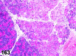 Figure 163