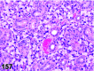 Figure 157