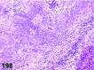 Figure 198