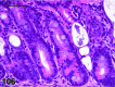 Figure 106