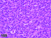 Figure 155