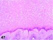 Figure 47