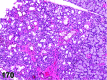 Figure 170