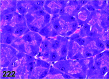 Figure 222