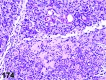 Figure 174