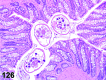 Figure 126