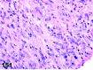 Figure 151