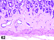 Figure 62
