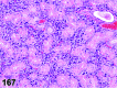 Figure 167