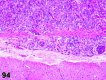 Figure 94