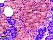 Figure 215