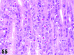 Figure 55