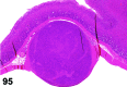 Figure 95