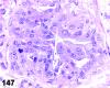 Figure 147