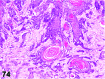 Figure 74