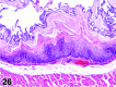 Figure 26