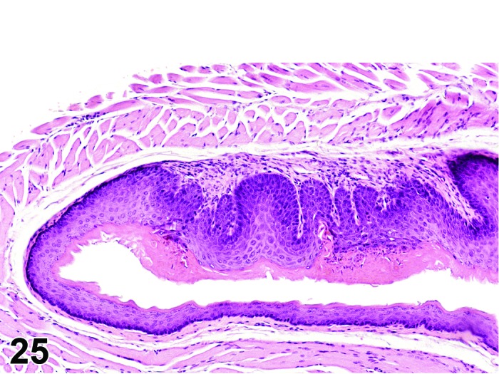 Figure 25