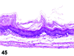 Figure 45