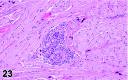 Figure 23
