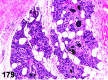 Figure 179