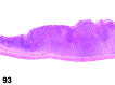 Figure 93